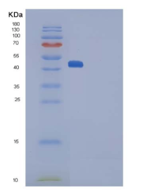 Recombinant Rat SerpinF1 / PEDF Protein (His Tag)