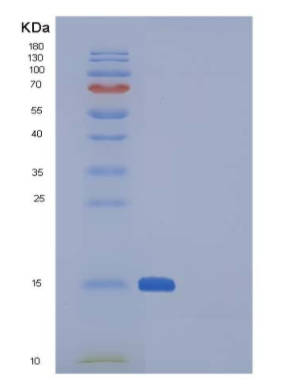 Recombinant Human SNCA / alpha-Synuclein Protein