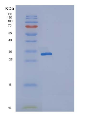 Recombinant Human Osteonectin / SPARC Protein (His tag)