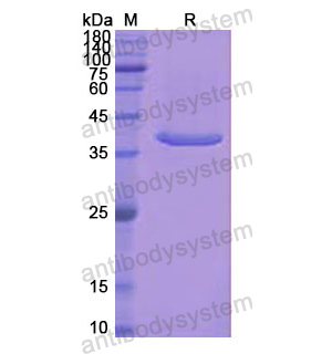 Recombinant Human ACYP1, N-GST