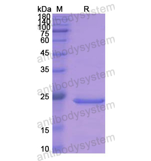 Recombinant Human ADH1A, N-His