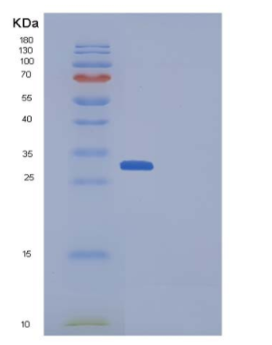 Recombinant Aequorea victoria GFP Protein (His Tag)