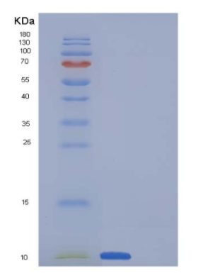 Recombinant Human Uteroglobin / SCGB1A1 Protein (His tag)