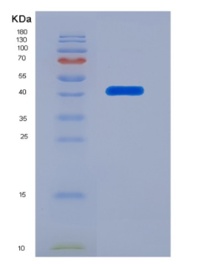 Eukaryotic B-Cell Activating Factor (BAFF)