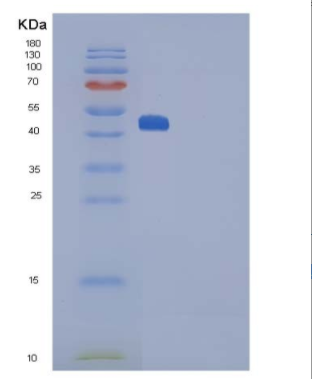 Recombinant Rat Interleukin 25 / IL25 / IL17E Protein (Fc tag)