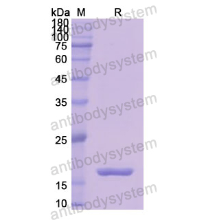 Recombinant Human CTSD, N-His