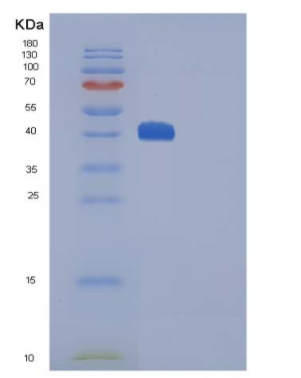 Recombinant Mouse CTLA4 / CD152 Protein (Fc tag)