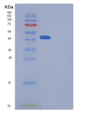 Recombinant Human HVEM / TNFRSF14 Protein (His & Fc tag)