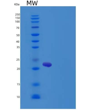 Recombinant Rat IL6 / Interleukin-6 Protein