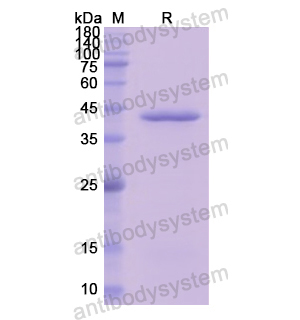 Recombinant Human C8B, N-His