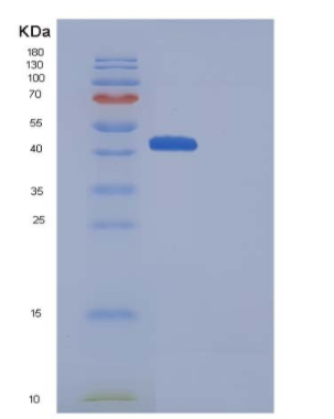 Recombinant Mouse CD70 / CD27L / TNFSF7 Protein (Fc Tag)