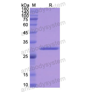 Recombinant Human TUBB/Tubulin beta, N-His