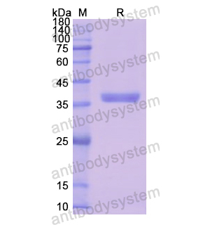 Recombinant Human DCN, N-His