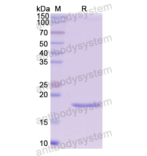 Recombinant Human HEXB, N-His