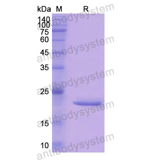 Recombinant Human CTSL, N-His