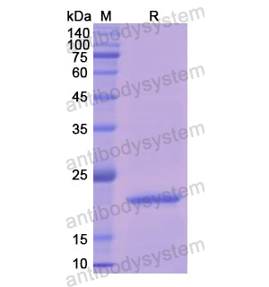 Recombinant Human APRT, N-His