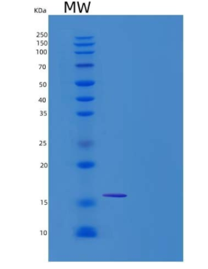 Recombinant Human BAMBI Protein (His Tag)