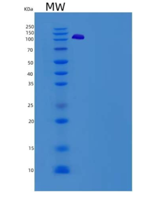 Recombinant Human VCL / Vinculin Protein (His tag)