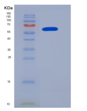 Eukaryotic Neuropilin 1 (NRP1)