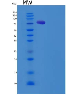 Recombinant Human PDE9A Protein (His & GST tag)