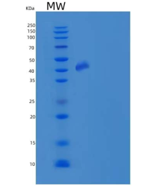 Recombinant Human WTAP Protein (GST tag)