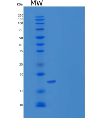 Recombinant Human REG1B / PSPS2 Protein (His tag)