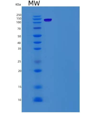 Recombinant Human P63 / TP63 / Tumor protein p63 Protein (His & GST tag)