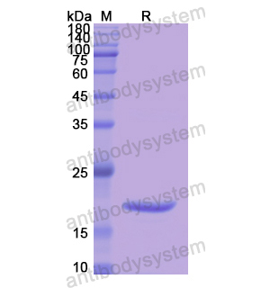 Recombinant Human SERPINA6, N-His