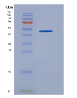 Recombinant Human KIR2DL1 / CD158a Protein (Fc tag)