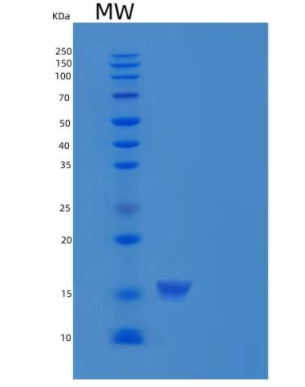 Recombinant Human ERP72 / PDIA4 Protein (His tag)