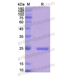 Recombinant Human GUSB, N-His