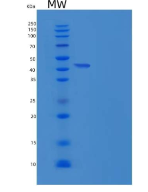 Recombinant Human TMED1 Protein (Fc tag)