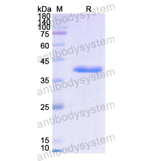 Recombinant Human ASNS, N-His