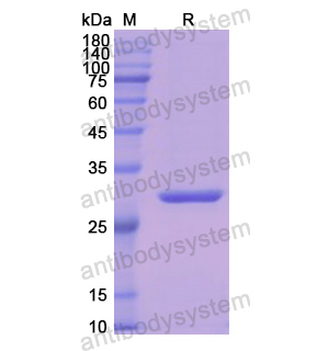 Recombinant Human HMBS, N-His