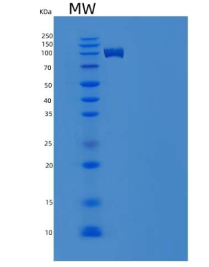 Recombinant Mouse CHL-1 Protein (His tag)