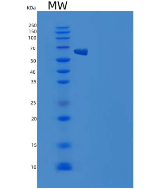 Recombinant Mouse IL1R2 / CD121b Protein (Fc tag)