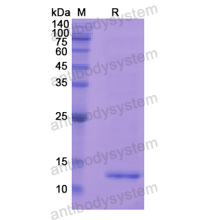 Recombinant Human MGP, N-His