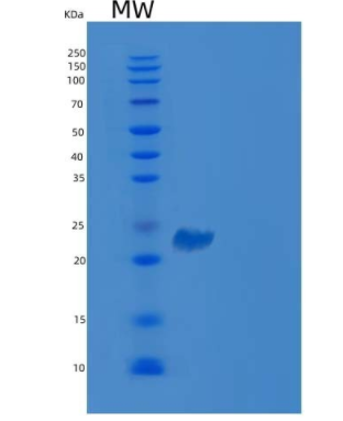 Recombinant Human VSIG2 Protein (His Tag)