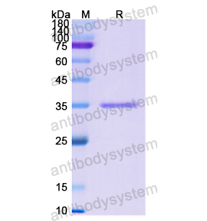 Recombinant Human MET/c-Met/HGFR Protein, N-His