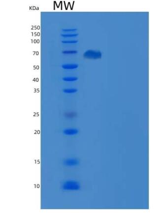 Recombinant Human Tie2 / CD202b / TEK Protein (His & GST tag)