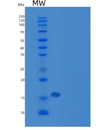 Recombinant Human PMP2 / FABP8 Protein (His tag)