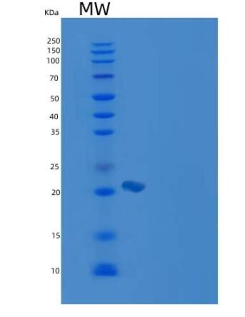 Recombinant Mouse CD2 / LY37 Protein (His tag)