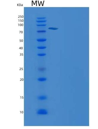 Recombinant Mouse PTPN6 Protein (aa 207-597, His & GST tag)