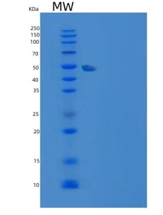 Recombinant Human TERF1 / TRF1 Protein (His tag)