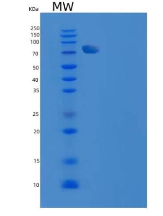 Recombinant Rat RBP4 Protein (His tag)