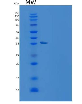 Recombinant Human AKR1B1 Protein (His tag)