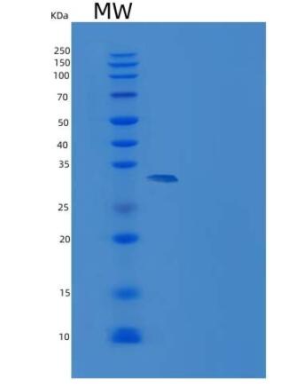 Recombinant Human sFRP1 / SARP2 Protein (His tag)