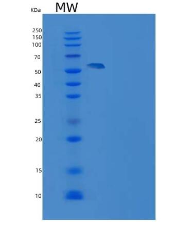 Recombinant Rat KIM-1 / TIM1 / HACVR1 Protein (His & Fc tag)