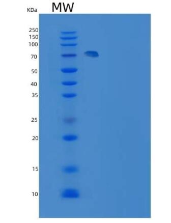 Recombinant Human MEK2 / MAP2K2 / MKK2 Protein (GST tag)