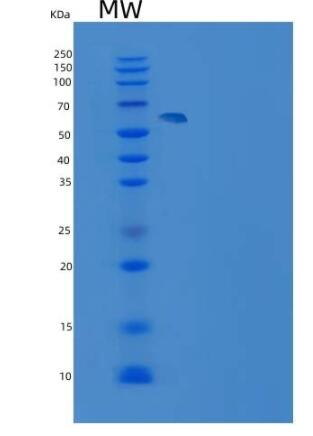 Recombinant Rat GPT2 Protein (His tag)